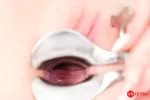 Speculum in Action – Image 3